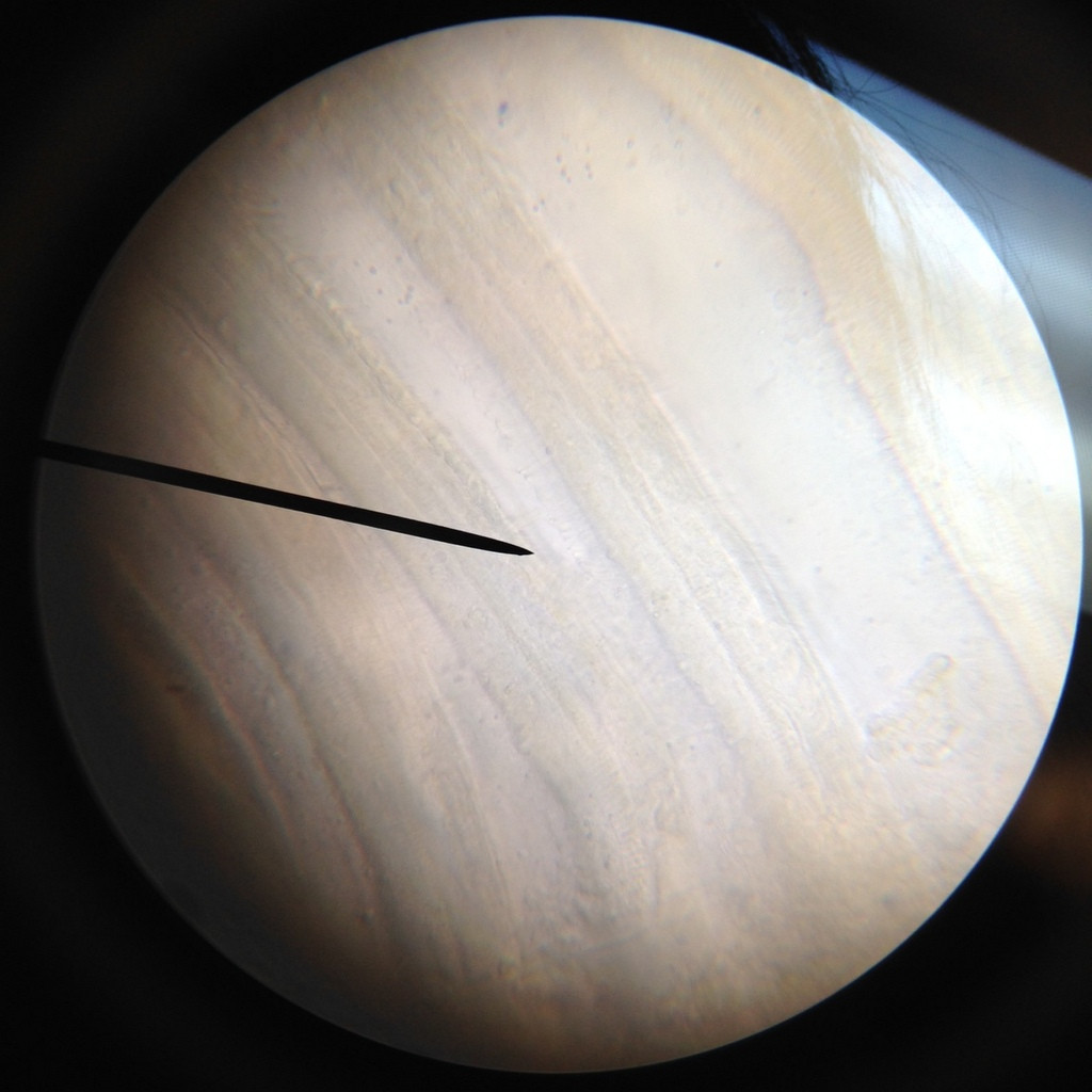Musseling in on Cilia